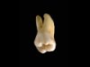 Anatomia do primeiro molar superior 16 1ºMS