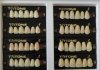 Seleção de dentes em Prótese Total